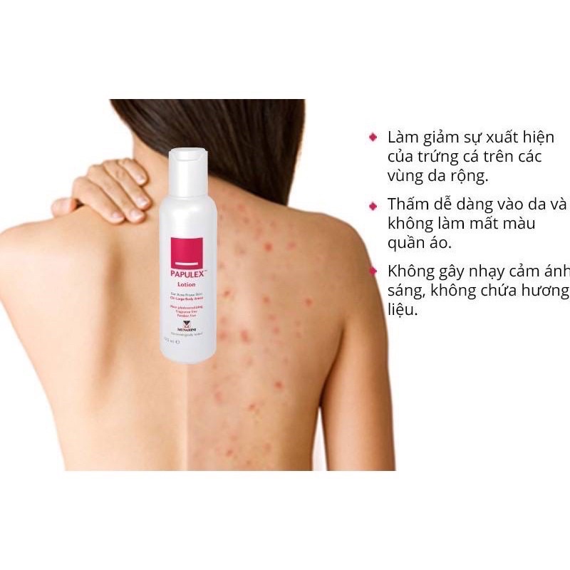 Giảm mụn lưng trong 7 ngày Papulex lotion 125ml