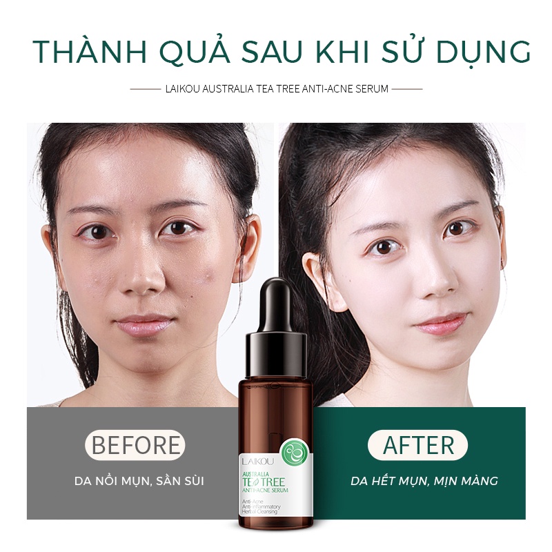 Serum Tràm Trà Dưỡng Da Tự Nhiên LAIKOU Ngăn Ngừa Mụn Giảm Thâm Nám Chăm Sóc Làn Da Hiệu Quả Zentop