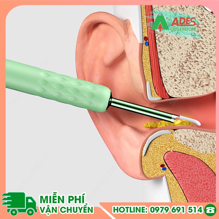 Dụng cụ lấy ráy tai thông minh Xiaomi Bebird R1 / Bebird R3 - Bảo Hành Chính Hãng