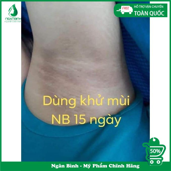 Bột khử mùi hôi nách ngân bình loại bỏ mùi hôi chân khó chịu,thâm sạm vùng nách,hết đen nách,se lỗ chân lông