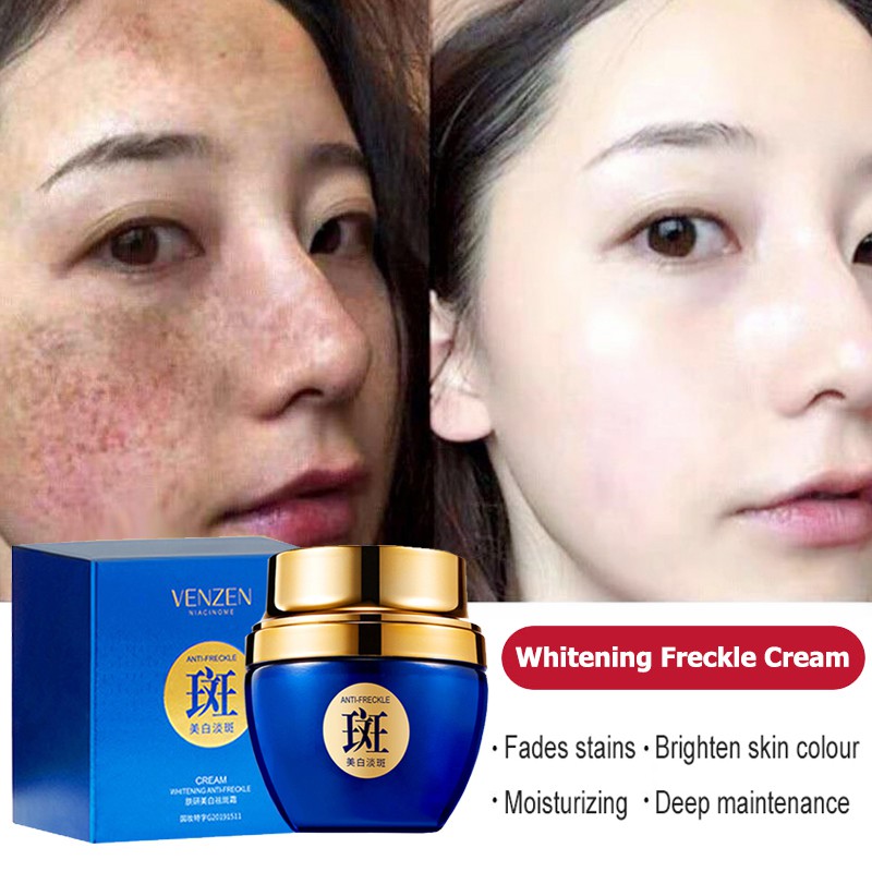 (Hàng Mới Về) Kem Làm Trắng Da Loại Bỏ Tàn Nhang Và Nếp Nhăn Venzen 50g