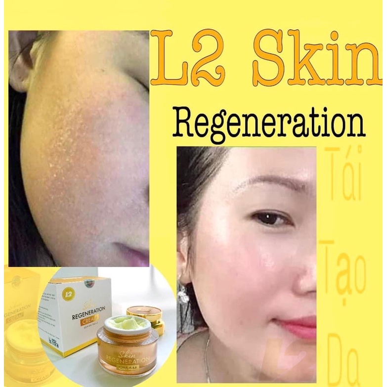 KEM TÁI TẠO DA L2 SKIN   𝐒𝐤𝐢𝐧 𝐑𝐞𝐠𝐞𝐧𝐞𝐫𝐚𝐭𝐢𝐨𝐧 𝐂𝐫𝐞𝐚𝐦 30gram