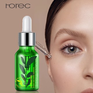 Serum trà xanh tieu diet mun trắng da se lỗ chân lông