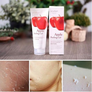 [Arrahan Chính Hãng] Gel Tẩy tế bào da chết Arrahan Peeling Gel 180ml - Làm Trắng Da Sạch Mụn | BigBuy360 - bigbuy360.vn