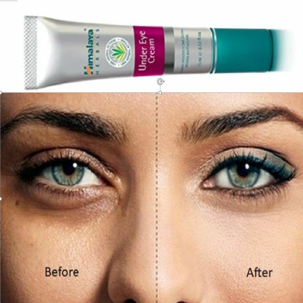 Kem dưỡng giảm thâm quầng mắt Himalaya Under Eye Cream 15g