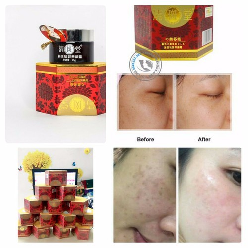 [SUMMER SALE] Kem Vua Khử Nám Nhật Bản hàng đẹp, nắp xốp | BigBuy360 - bigbuy360.vn