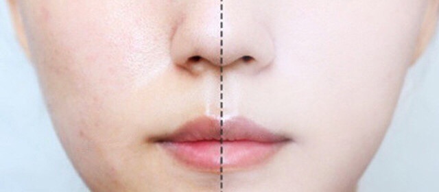 KEM DƯỠNG TRẮNG DR.ALTHEA POWER WHITENING GLUTATHIONE CREAM