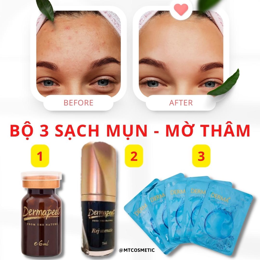 Combo sạch mụn mờ thâm mụn dermapeel - tảo trứng cá tuyết - serum trứng cá tuyết - nạ derma dịu da nhanh
