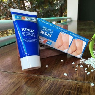 [ Hàng Chính Hãng] Kem Nứt Gót Chân Kpem Nga 50ml