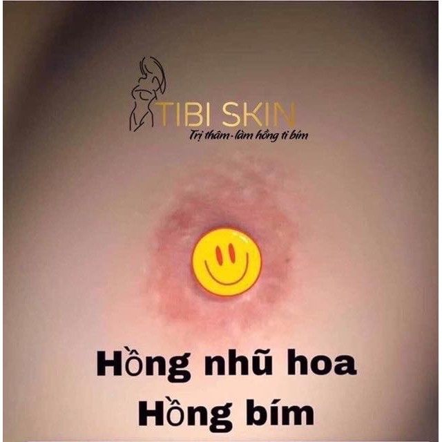 TIBI SKIN TRI THÂM MÔI, NHỦ HOA, HỒNG VÙNG KÍN HIỆU QUẢ SAU 1,2 tuần sd