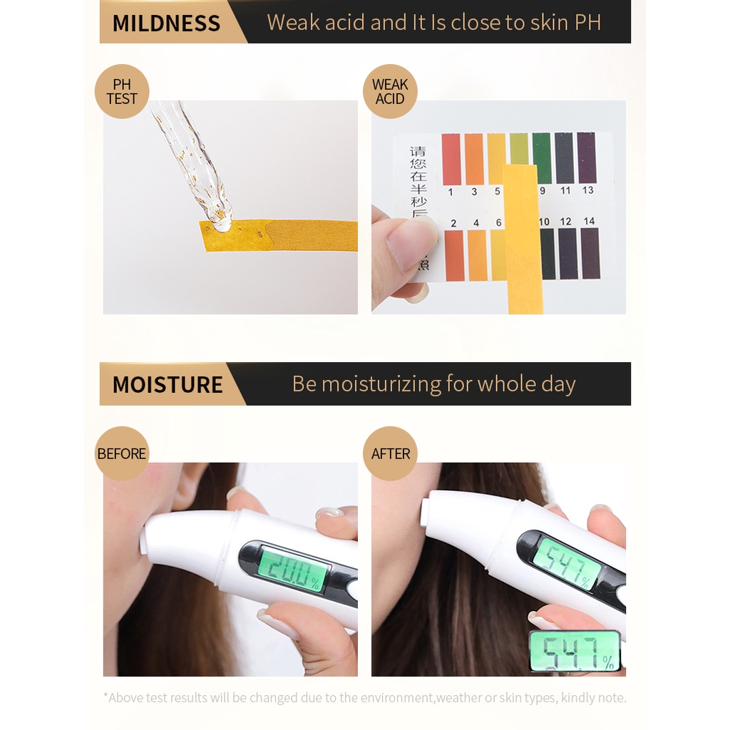 Serum Fenyi tinh chất ốc sên chống lão hóa &amp; nếp nhăn 30ml