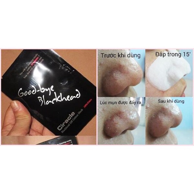 Lẻ Miếng Mặt Nạ Đẩy Mụn Goodbye Blackhead Ciracle | BigBuy360 - bigbuy360.vn