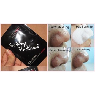 Lẻ Miếng Mặt Nạ Đẩy Mụn Goodbye Blackhead Ciracle