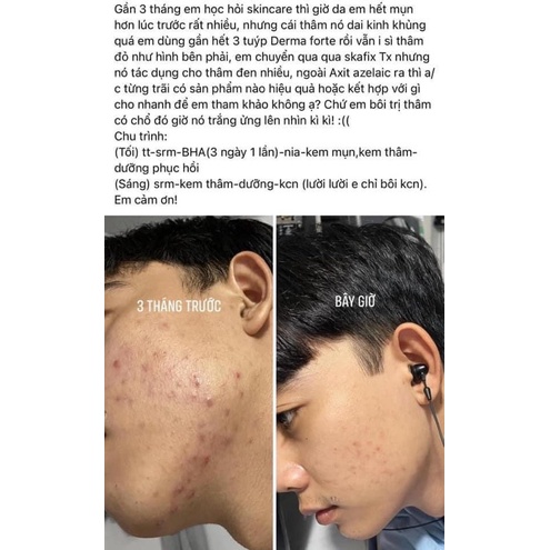 Kem dưỡng sáng da mờ thâm mờ tan nhag Skarfix-TX Fixderma