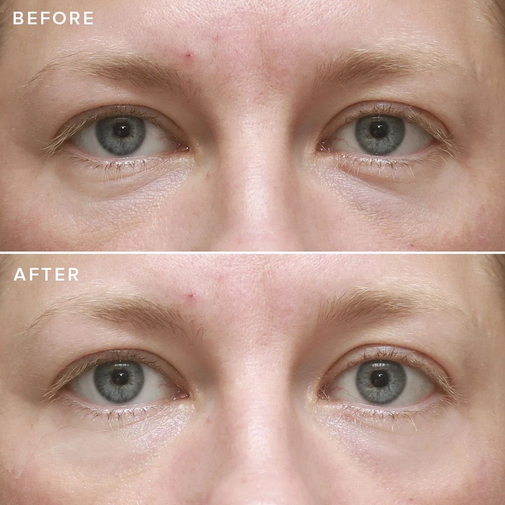 FARMACY 🌿 Kem Dưỡng Giảm Quầng Thâm Mắt Cheer Up Brightening Vitamin C Eye Cream with Acerola Cherry | BigBuy360 - bigbuy360.vn