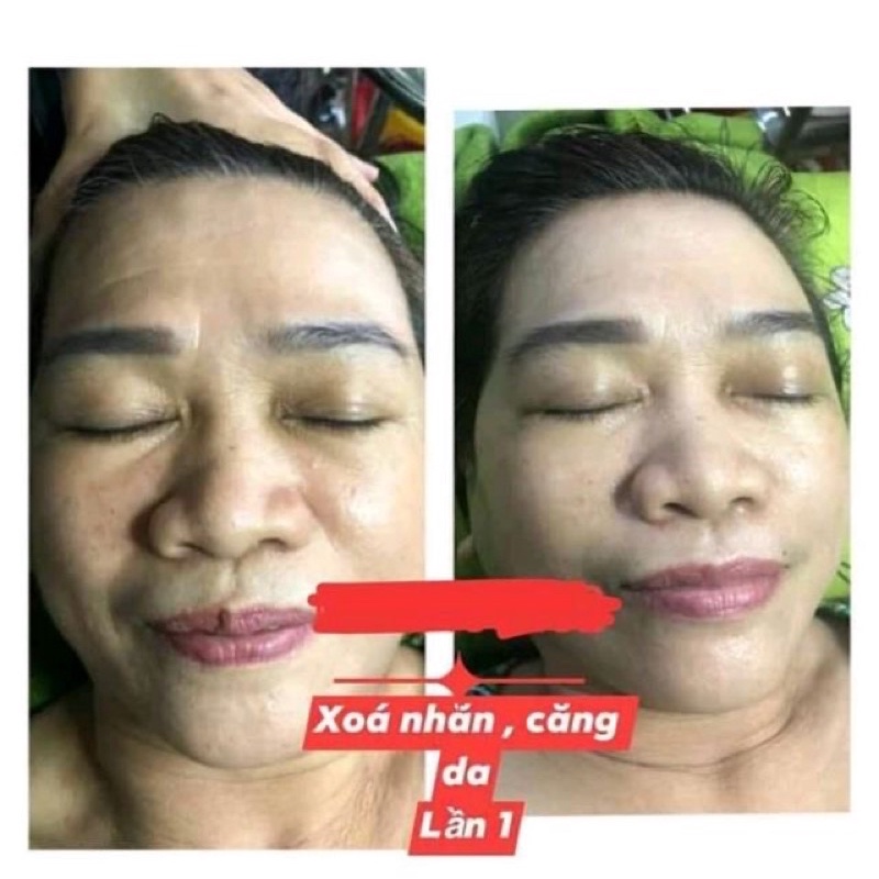 Serum nâng cơ trẻ hoá Trương Mai trong bộ cấy trắng bạch mộc