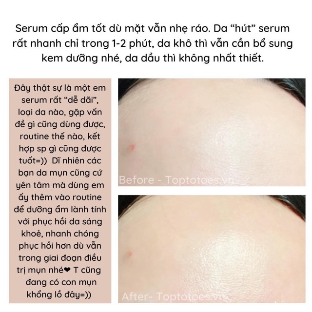 Serum Teana Super Peptides Crystal Skin làm căng bóng da, dưỡng ẩm