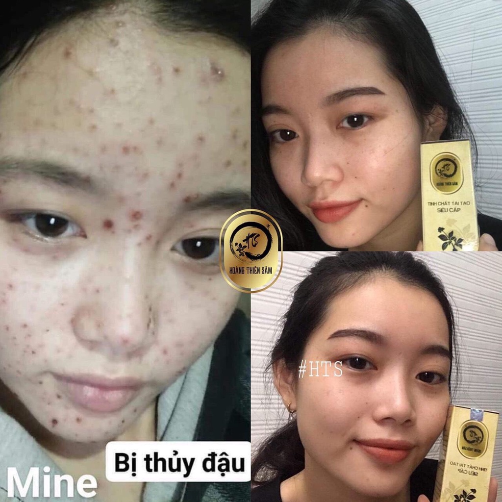 Combo Hoàng Thiên Sâm VIP (Bọt rửa mặt 100ml và Serum 30ml)