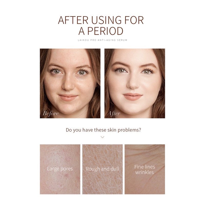 (Hàng Mới Về) Serum Lewedo 15ml Kiềm Dầu Tẩy Tế Bào Chết Cho Da Mặt | BigBuy360 - bigbuy360.vn