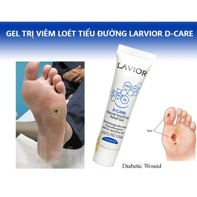 [Hỏa tốc] Lavior Diabetic Wound Gel 7ml - Làm lành vết thương, vết loét tì đè, loét chân tiểu đường, trầy xước da, bỏng