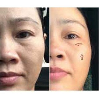 Trẻ hoá da TRUFACE ESSENCE ULTRA (NUSKIN)