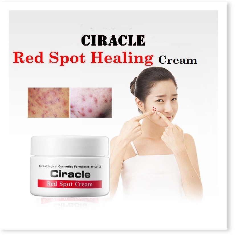 [Mã giảm giá] Kem làm giảm mụn sưng đỏ, mụn mủ, giúp giảm mụn, ngăn ngừa sẹo rỗ Ciracle Red Spot Cream 30g