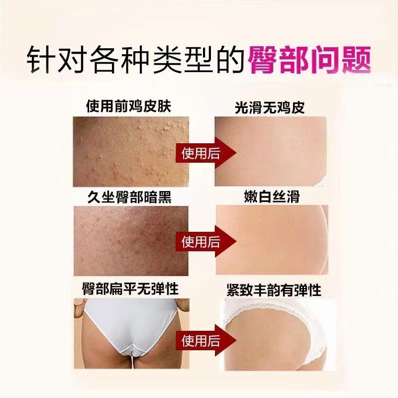 Mặt nạ mông sáng da trj mụn th-âm mông CHOVEMOAR