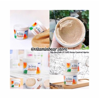 Tẩy da chết St.ives