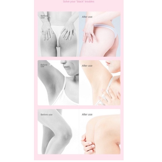 Xà phòng giảm thâm mông, bẹn, đầu gối giúp da sáng mịn màng