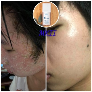 [mua 1 tặng 2] Tế bào gốc C-Cell MKII 30ml MKII