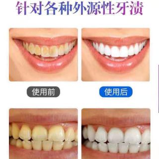 Kem đánh trắng răng Baking soda