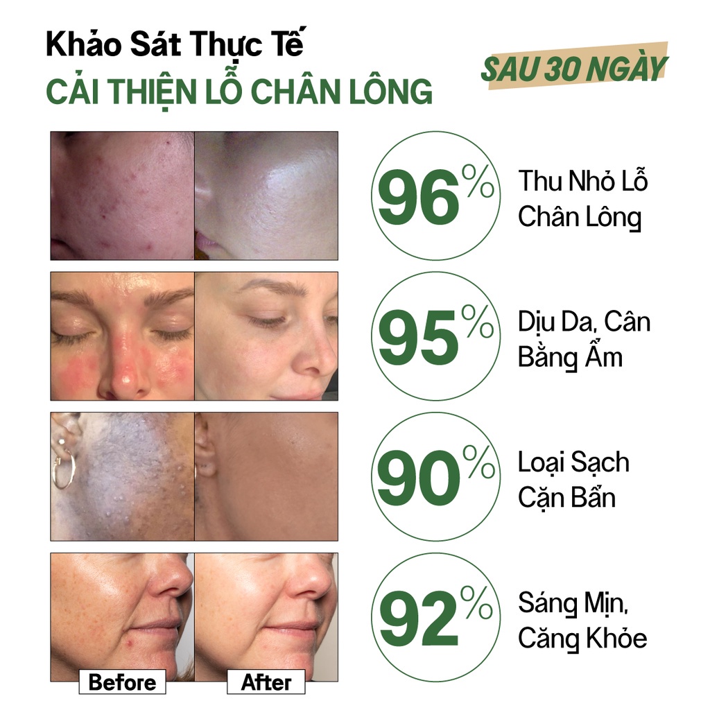 Bộ Đôi cân bằng da, dưỡng ẩm chuyên sâu Vegick (Nước Cân Bằng Thuần Chay 210ml &amp; Kem Dưỡng Ẩm Thuần Chay 50ml)