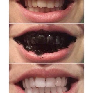 Bột trắng răng than tre hoạt tính