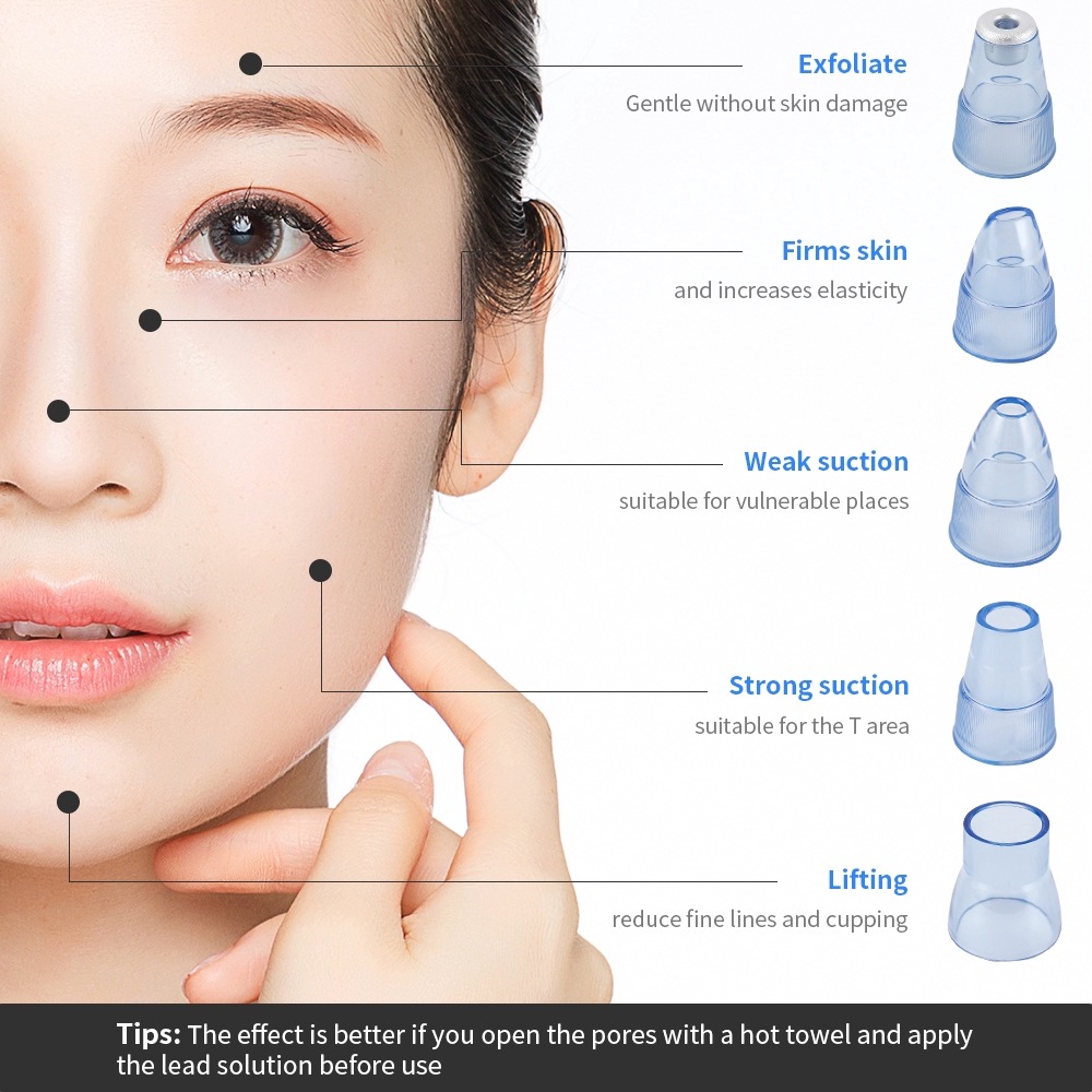 Máy Hút Mụn Đầu Đen Cầm Tay Tiện Lợi