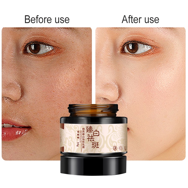 beautysecret kem dưỡng trắng da mặt chiết xuất thực vật loại bỏ tàn nhang 30g | BigBuy360 - bigbuy360.vn