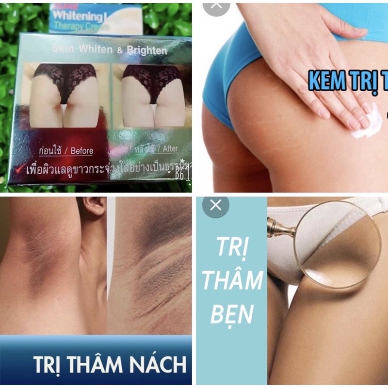 [Chỉ Bán Hàng Thái] Kem thoa thâm Mông, mụn Mông, Bẹn, Nách, Lưng, Nhũ hoa, Cùi chỏ, Đầu gối .... Thái Lan