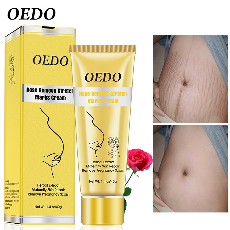 OEDO Rose Remove Stretch Marks Cream 40g | BigBuy360 - bigbuy360.vn