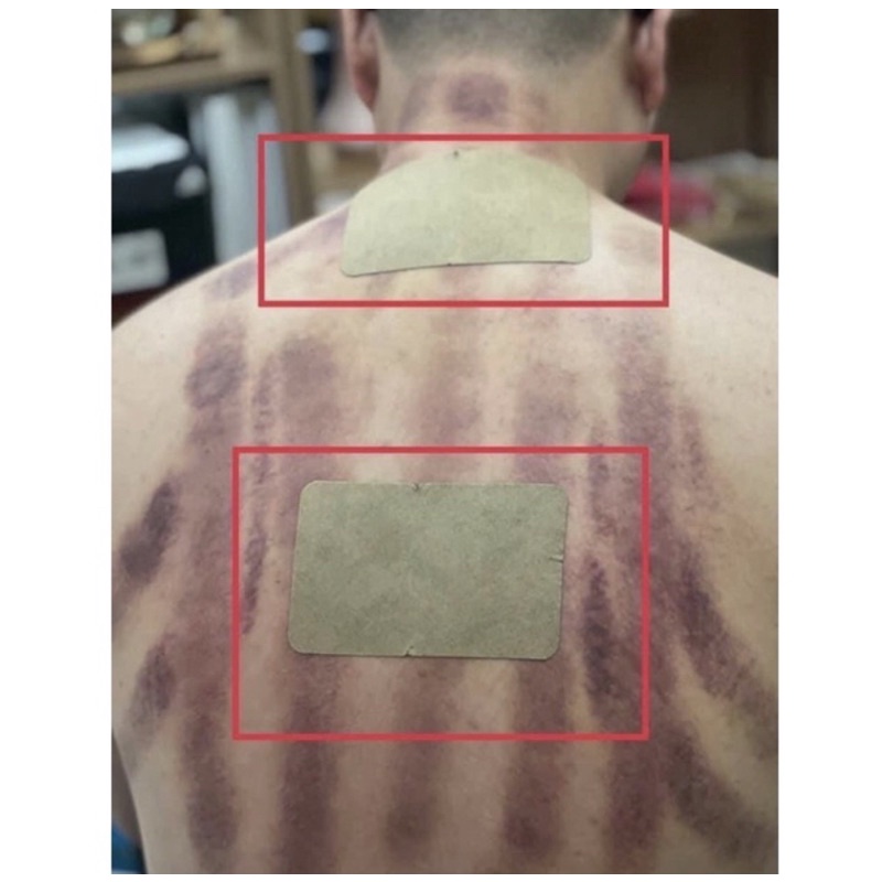 CAO DÁN NGẢI BÀI TRỪ HÀN ẨM CẢI THIỆN NHỨC MỎI XƯƠNG KHỚP