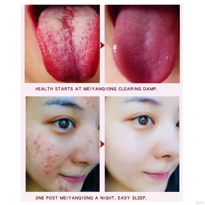 [Hàng mới về] Bộ 10 miếng dán bàn chân chăm sóc hỗ trợ giảm thống kinh giúp ngủ ngon | BigBuy360 - bigbuy360.vn