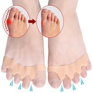 Bộ dụng cụ tách ngón chân cái