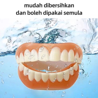 Răng giả niềng răng chất lượng cao