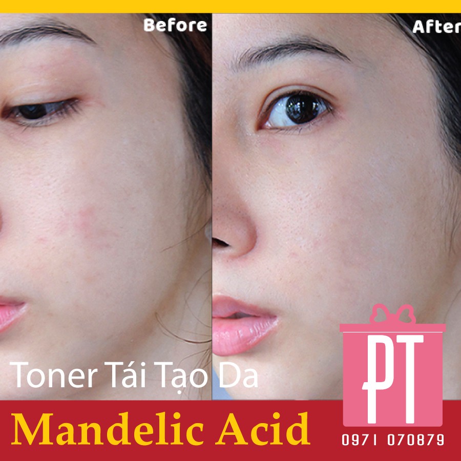 Essence (Toner) Dr.wu MA Đài Loan giúp làm sạch sâu, tái tạo da 150ml