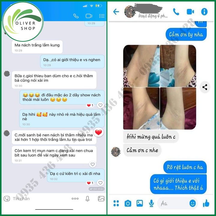 Khử Hôi Nách Thâm Nách ⚡SIÊU TO+QUÀ TẶNG⚡ Kem Cô Bơ Size Lớn Siêu Tiết Kiệm Chính Hãng 100%