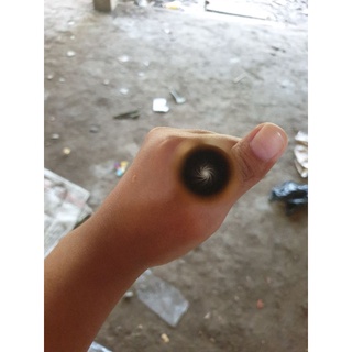 Lup 5 .5 od 8 và 9
