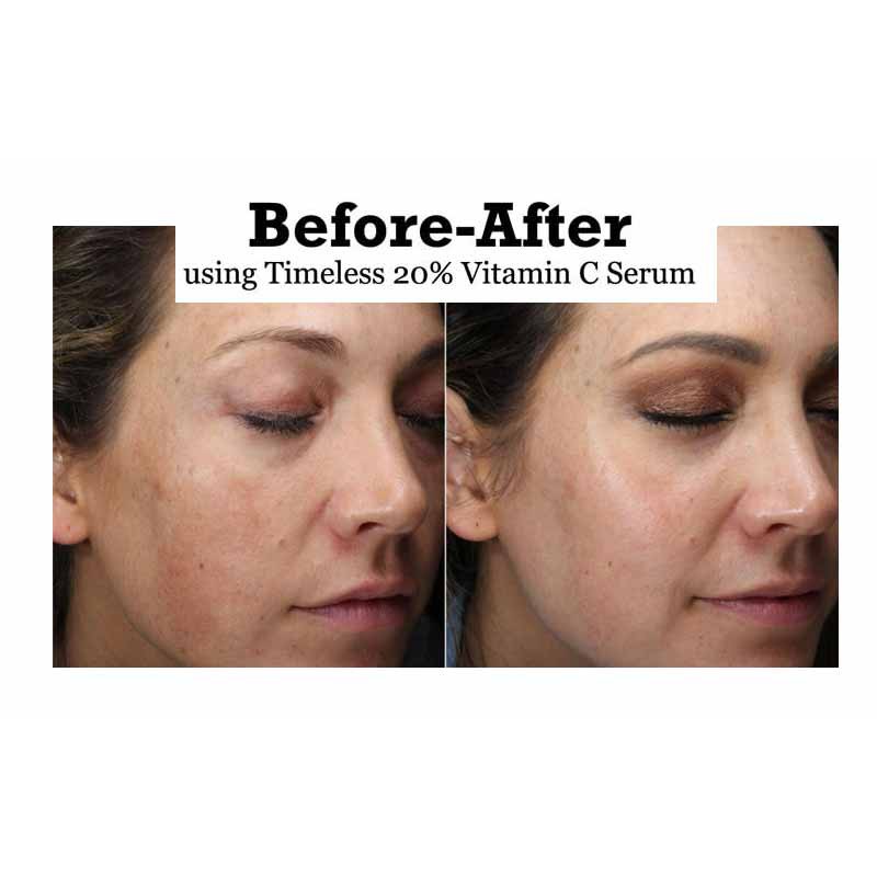 Tinh Chất Timeless Vitamin C 20% | BigBuy360 - bigbuy360.vn