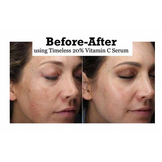Tinh Chất Timeless Vitamin C 20%