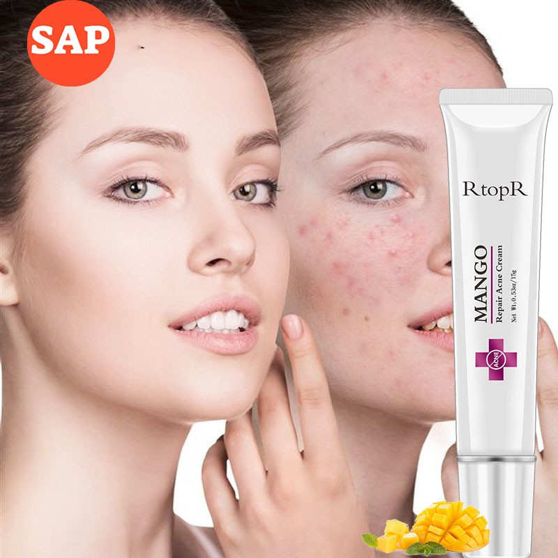 Kem Giảm Mụn Trứng Cá, Ngừa Thâm, Mờ Sẹo, Dưỡng trắng mịn, tăng collagen cho da Mango cream