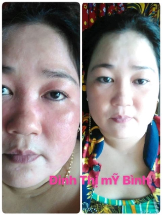 collagen plus vit e