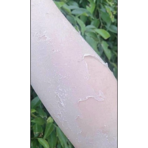 500gr kem body bong da tái tạo