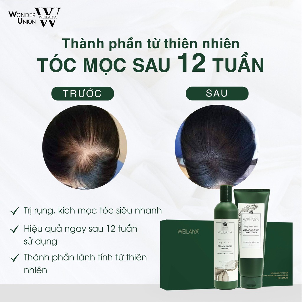 Kích Thích Mọc Tóc Nhanh với Huyết thanh Serum Mọc Tóc Weilaiya Chính Hãng 1 Lọ 5ml Cam Kết Hiệu Quả Sau 12 Tuần sử dụng